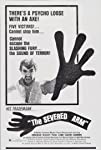 The Severed Arm