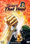 Scars That Heal: The Dave Roever Story