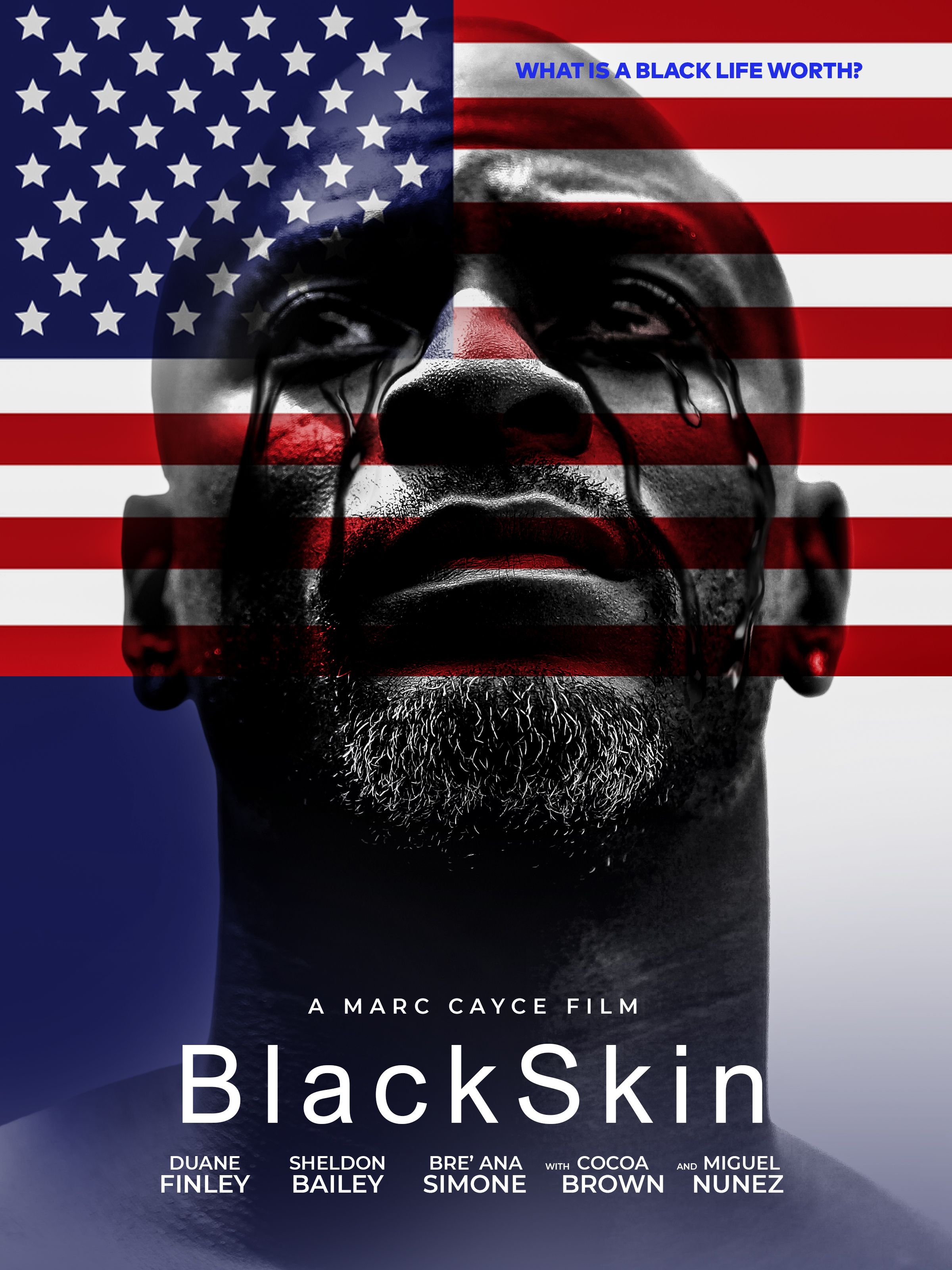 #BlackSkin